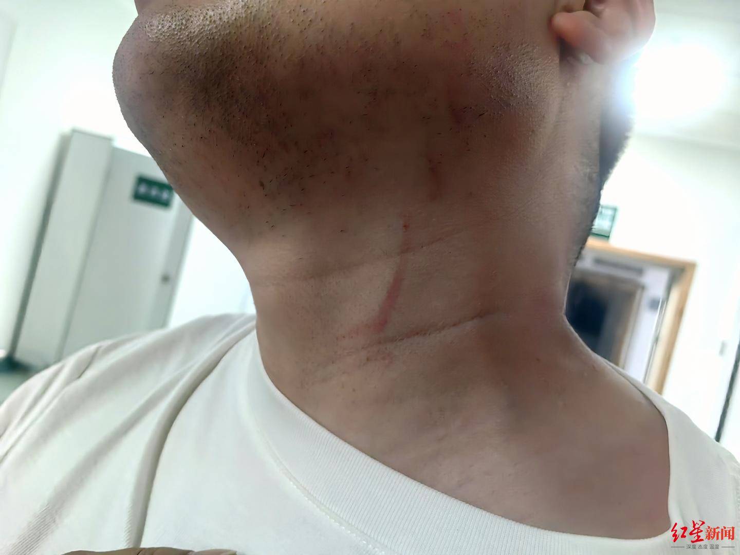 武漢男子拍攝違停時被當街毆打，打人者被罰款500元，被打者稱將提起行政復議并起訴